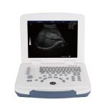 Laptop Ultrasound MU10 For Livestock - سونار لابتوب شامل - مع بروبين